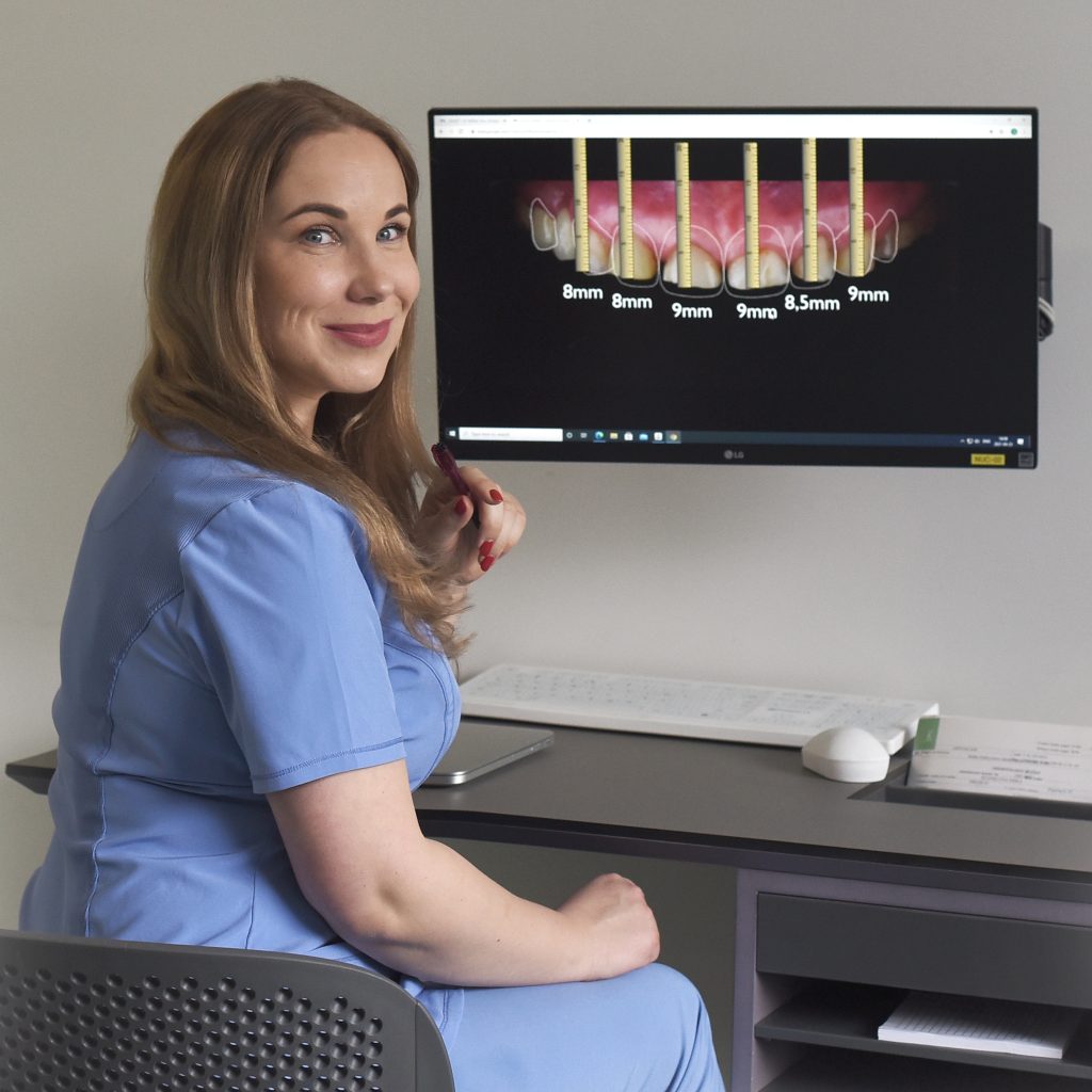 Dantų laminatės ekrane ir odontologė ortopedė Jolanta Leškevičiūtė