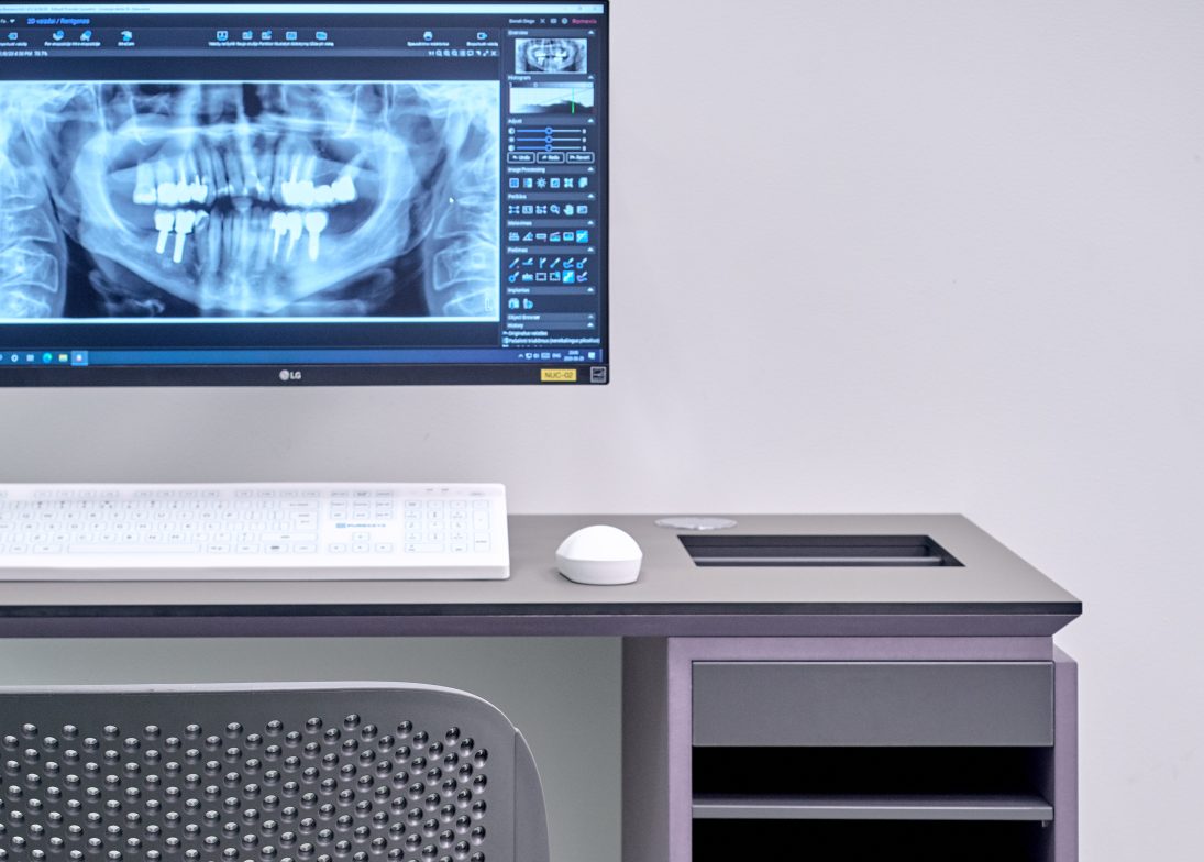 Kompiuterio stalas su kompiuteryje matoma dantų rentgeno nuotrauka