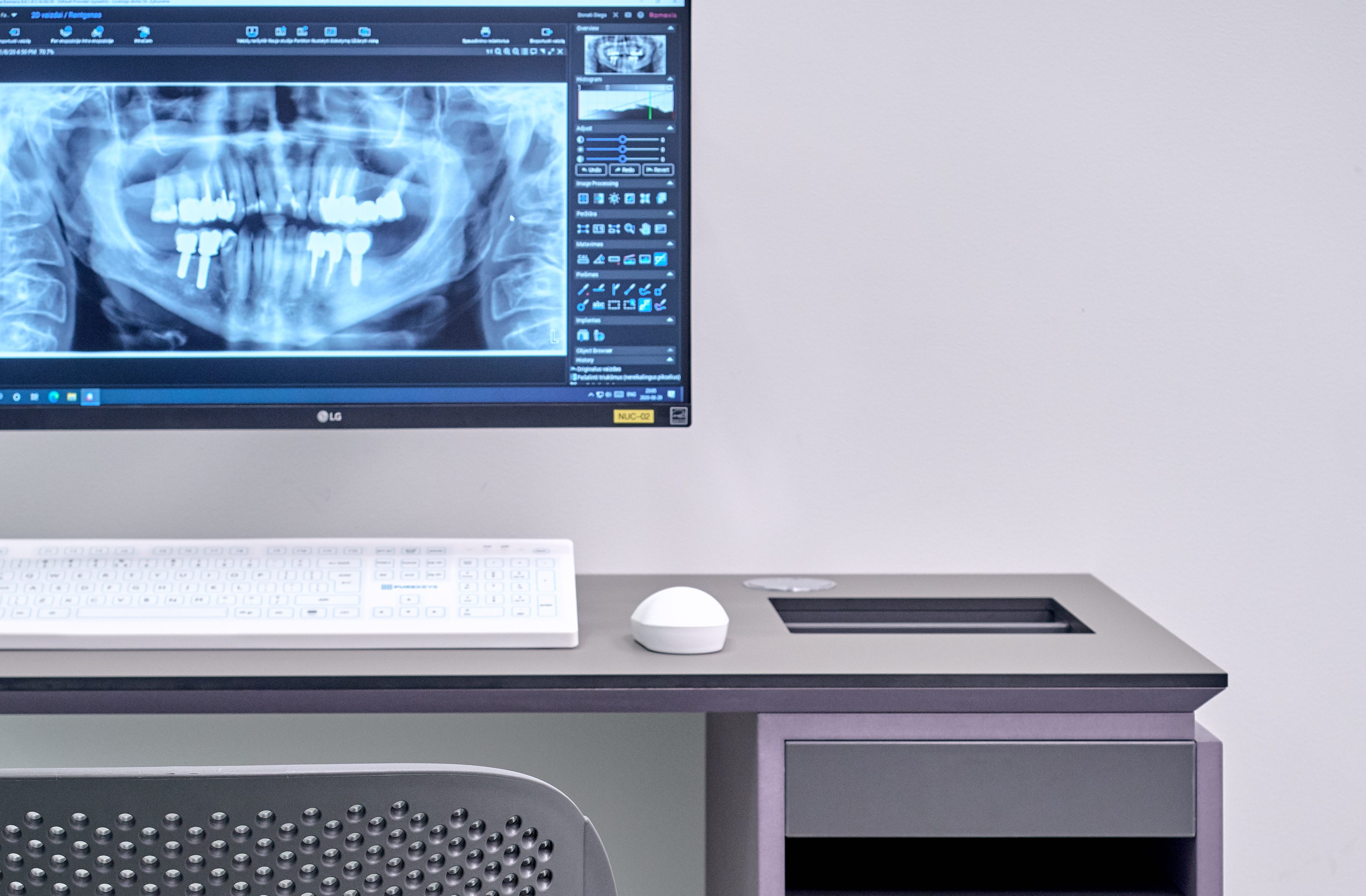 Kompiuterio stalas su kompiuteryje matoma dantų rentgeno nuotrauka