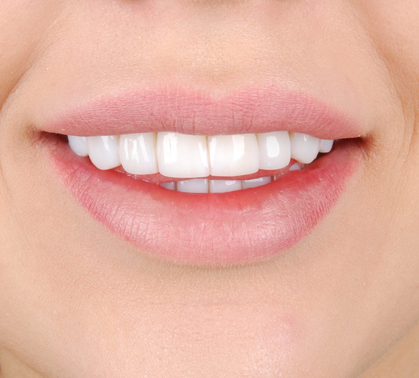 Šypsena po dantenų uždegimo gydymo ir estetinio plombavimo korekcijos
