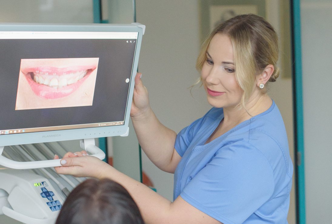 Jolanta Leškevičiūtė rodo dantų laminates