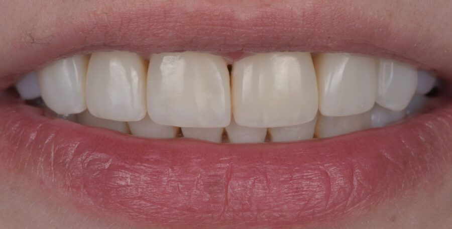 Dantys po tiesinimo kapomis